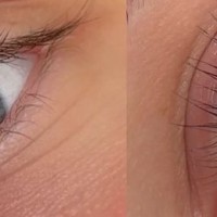 Bestes Wimpernlaminierungs-Set – objektives Ranking